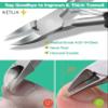 Ketlix Toe Nail Clipper, Professional Thick & Ingrown Toenail Tool, Sharp Curved Blade, Black view 3