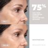 5minskin Microcurrent Facial Device  Micro Sculpting Face Lift Neck Massager | Skin Tighten and Rejuvenation Machine | Anti-Aging Wrinkle Remover | Galvanic Machine view 3