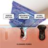 BeautyBio GLOfacial Hydro-Infusion Deep Pore Cleansing + Blue LED Clarifying Tool & Concentrates view 3