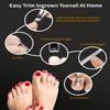 EBEWANLI Ingrown Toenail Tool, 6 PCS Stainless Steel Pedicure Tool, Straight Edge and Curved Slanted Nail Clippers Cutters for Ingrown Toenail Correction Removal Kit at Home for Seniors, Men, Women view 2