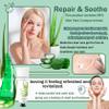 JunKuJK 99% Purity Aloe Vera Gel - Hydrating Aloe Vera Gel for Face and Skin,No Sticky Moisturizing Aloe Gel(5 pcs) B view 2
