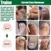 Titanium Ingrown Toenail Corrector,Nail repair tools,Ingrown Toenail Treatment,Suitable for most people with ingrown toenailsIngrown Toenail Removal Kit,- Designed for Ingrown Toenail Repair view 3