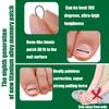 Titanium Ingrown Toenail Corrector,Nail repair tools,Ingrown Toenail Treatment,Suitable for most people with ingrown toenailsIngrown Toenail Removal Kit,- Designed for Ingrown Toenail Repair view 4