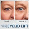 AEEHFENG Dobshow DERMA+ Firm Peptide Firming Eye Gel,Open Eyes Awaken Peptide Lifting Eye Gel,Natural Lifts Firming Eye Serum for Remove Eye Bags, Dark Circles & Eye Wrinkles (3 Pack) view 4