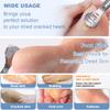 36 Pcs Callus Shaver for Feet Set, (1Stainless Foot File &1 Foot File Heads & 30 Replacement Slices Blades & 4 Pedicure Knife), Professional Callus Remover for Feet Tools for Wet and Dry Feet view 4