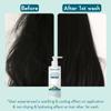 WishCare Anti Dandruff Conditioner for Dry & Frizzy Hair - 200 ML view 2