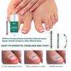 Ingrown Toenail Corrector & Removal Kit - at Home Treatment for Ingrown Toenails, Titanium Alloy Ingrown Toenail Treatment Tools Designed for Curved Nail Repair Suitable for Men Woman (0.59/0.67in) view 3