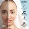 Jekyll brand COSMETICS | Chin Cleansing Patch-XL (12 counts) | Hydrocolloid | Medical Grade Chin Patch | Targets Pimple and Blemish | Pore Cleansing Strips |**Dermatologist Approve** view 4
