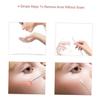 Baluue Pimple Popping Tool Kit Acne Remover Tools Facial Cleansing and Storage Case view 2