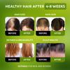 Batana Oil for Hair Growth - 100% Raw & Organic Unrefined Batana Oil - Cold Pressed Hair Mask for Scalp Health, Thicker Hair & Split Ends Repair - Natural & Pure (4.23 oz) view 2