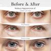 BLOOMORA Variety Under Eye Patches (30 Pairs) Under Eye Patches for Dark Circles and Puffy Eyes, Under Eye Mask, Eye Care, Puffy Eyes Treatment, Eye Masks Bulk, Bachelorette Party Favors view 4