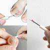 DeaHea 10 Pack Ingrown Toenail Lifter Precision Ingrown Toenail Removal Kit Nail Cleaner Pedicure Tools for Ingrown Toenail Corrector Set Ingrown Toenail Treatment Toenails Straightener Strips view 4