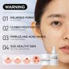 LANBENA 3 in 1 Blackheads Removing Kit, Nose Pore Strips 30g+Pore Serum 30ml+ Strip Paper, Black Head Remover Mask for Nose, Pore Minimizer for Face view 4