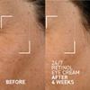 Dr. Brandt Skincare BTW 24/7 Retinol eye cream 0.5 oz. / 15 g view 2