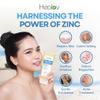 Zinc Face Wash | Zinc Soap Skin Therapy Body Cleanser for Acne, Rosacea, Eczema, Dermatitis, Psoriasis, Itching | Cleansing, Calming Facial Wash | Exfoliating Zinc Face & Body Wash for All Skin Types view 2