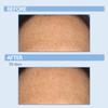 Retinol Vitamin A Resurfacing Pads for Daily Facial Treatment - Niacinamide & Witch Hazel - Exfoliates Skin & Pores - Reduces Fine Lines and Wrinkles - Serious Skincare - 60 Pre-Moistened Disc view 3