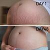 PEGO Stretch Mark Oil for Pregnancy, Maternity Body Oil for Stretch Mark Prevention & Reduction, Hydrating Skin Care, 4.06oz (2Pack) view 4