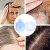 SOESFOUFU 3pcs Scalp Massage Comb Applicator for Hair Treatment Material Palm-sized Design Even Medicine Distribution for Hair Scalp Care view 4
