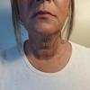 New Neck Miracle Tape view 3