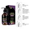 Biotin, Rosemary and Onion Shampoo and Conditioner Set for Stronger, 2024 Onion Shampoo for Hair Growth, Smoother,Thicker and Longer Hair, Better for Hair Loss and Thinning (1PC) view 3