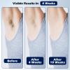LuxDuo IPL Hair Removal, Whole Body Hair Removal for Men and Women at Home, Pain-Free & Long-Lasting for Body & Face Hair Removal, Effective in 2 Weeks with Ultra-Fast 0.2S Light Emission(Green) view 4