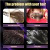 Biotin, Rosemary and Onion Shampoo and Conditioner Set for Stronger, 2024 Onion Shampoo for Hair Growth, Smoother,Thicker and Longer Hair, Better for Hair Loss and Thinning (3PCS) view 3