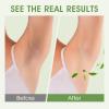 Armpit Detox Scrub with Tea Tree, Mint & Walnut Shell Powder, Underarm Scrub for Removing Odor & Exfoliating, Dark Armpit Remover, Natural Unisex Body Deodorant for Full Body Care 8.11 Oz view 4
