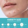 Safirst Sticky Acne Patches Hydrocolloid Pimple Absorbing Patch 4 Size 260 Counts Spot Blemish Invisible Stickers Zit Dot Cover Breakout Treatment view 3