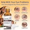 5% Caffeine Solution, Anti Wrinkles Caffeine Serum For Eyes, Reduces Dark Circles & Puffy Eyes, 1 PCS Under Eye Essence For Fine Lines view 2