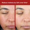 EltaMD UV Skin Recovery Green Tint All Mineral, Redness Reduction, Sensitive Skin Face Sunscreen SPF 50 view 4