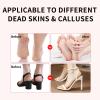 Dermave Electric Foot Callus Remover  Pedicure Tool with 60pcs Sanding Discs, Electric Foot Callus Remover, Callus Remover for Feet - Foot File for Dead Cracked Skin, Men/Women (Pink) view 3