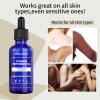 Cyperus Rotundus Oil - Natural Nut Grass Oil for Hair Removal, Reducing Body Hair Growth, Smooth Skin & Moisturizing, Soothing & Gentle, Ideal for All Skin Types (1pc, 60ml) view 4