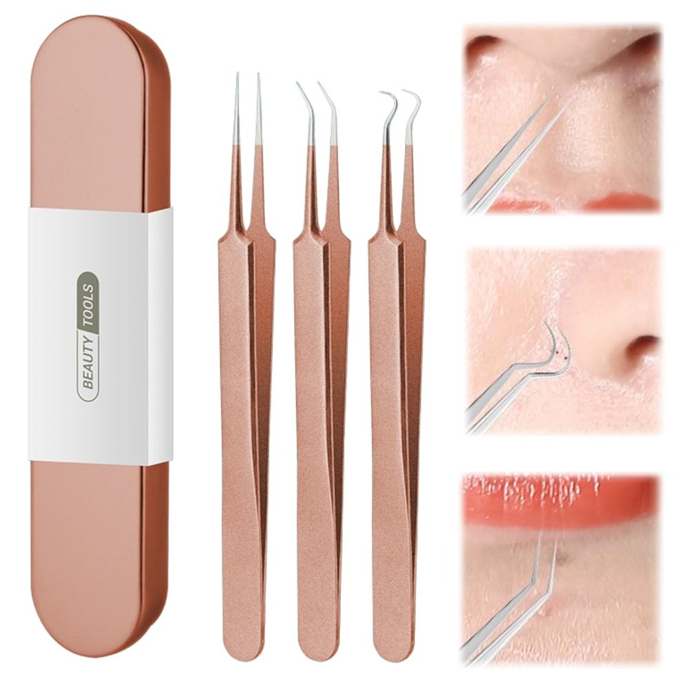 xwxwseui Usiveinborn Blackhead Remover Upgraded, Usiveinborn Blackhead Tweezers, Professional Upgraded Facial Blackhead Remover Tweezers, Blackhead Remover Tools Sets (A5-Rose-Gold-3pcs)