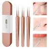 xwxwseui Usiveinborn Blackhead Remover Upgraded, Usiveinborn Blackhead Tweezers, Professional Upgraded Facial Blackhead Remover Tweezers, Blackhead Remover Tools Sets (A5-Rose-Gold-3pcs) view 1