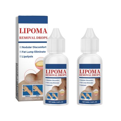 Herbal Lipoma Removal Drops,Lipoma Removal,Lipoma Removal Cream,Creating Perfect Skin,50ML/1.69FL.OZ (2pcs)