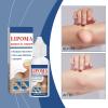 Herbal Lipoma Removal Drops,Lipoma Removal,Lipoma Removal Cream,Creating Perfect Skin,50ML/1.69FL.OZ (2pcs) view 2