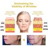 AEEHFENG Firming & Renewal Cream, Advanced Renewal Firming Moisturizing Cream, Deep Hydration, Restore Skin Elasticity for All Skin Types (3 Bottle) view 3