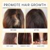 Batana Oil for Hair Growth - 4-in-1 Liquid Formula Rosemary Castor Pumpkin Seed Oil | Strengthens, Nourishes Damaged Hair | Natural Hair Regrowth for Thinning Hair view 3