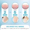 At Home Hair Removal for Women and Men, UTOURS Painless Hair Removal Device with Sapphire Cooling, Safe and Long-Lasting for Reducing in Hair Growth for Body & Face view 2