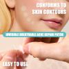 New Pimple Patches for Face, 3 Different Sizes Hydrocolloid Acne Patches,Large Pimple Patch Pimple Stickers for Covering Zits and Blemishes, Zit Patches Sticker for Face or Skin view 2