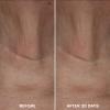 Glo Skin Beauty Bio-Renew EGF Neck Cream - Epidermal Growth Factor Neck + Dcollet Cell Repairing Formula, Reduce the Appearance of Wrinkles, Fine Lines Crepey & Sagging Skin view 4