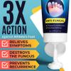 Foot Cream | Athletes Foot Cream for Cracked Heels, Dry Skin & Itchy Feet | Relieves Itching, Burning & Redness | Antifungal Treatment Helps with Nail Fungus, Jock Itch & Ringworm | 4.05 fl oz view 2