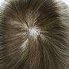 Healthlif Mens Toupee European Remy Human Hair Piece For Men V-looped Hair System For Men Ultra Thin Skin Toupee For Men Hairpiece Toupee 8X10#420#4 Medium Brown+20% Grey 80% Density view 4