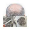 tanyunji001 Men's Wigs Bald Spot Hair Patch Toupee for Men 3.15x3.15 Inch Full PU Thin Skin Base Hair Patches Men's Hairpieces 6" Human Hair Topper Replacement Systems Baldness Wigs view 1