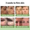 Luhaka STDEI Luxurious Collagen Firming Cream, Stdei natural collagen firming cream, Skin Tightening, Deep Moisturizing, For All Areas of the Body (2PCS) view 2