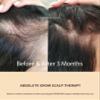 BIOCELLMED Copper Peptide Absolute GROW Scalp Serum with Copper Peptides and Plant Stem Cells for Hair, 1.05 oz view 2