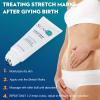 Stretch Mark Repair Cream is Formulated with Botanical Ingredients to Effectively Minimize Stretch Marks for a Smoother, More Even Skin Tone view 3
