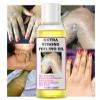 Extra Strong Peeling Oil, Yellow Peeling Oil for Dark Skin, Exfoliating Peeling Solution for Body, Hand, Feet and Face All Skin Type view 3