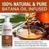 Batana Oil Hair Growth Conditioner: Natural Hair Thickening Moisturizing Product for Thinning Hair for Women and Men - Daily Hair Care at Home - 11.8 fl.oz view 2