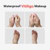 Vitiligo Cover Up Makeup, XISHENGYAN Waterproof Cosmetic Concealer for Skin Vitiligo, Long Lasting White Spots Natural Camouflage Liquid Pen, How to Cover Vitiligo Patches, Use on Face, Hands and Body view 3